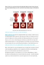 Những điều chưa biết về bệnh viêm lộ tuyến cổ tử cung