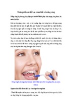 Những điều có thể bạn chưa biết về niềng răng