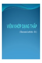 Viêm khớp dạng thấp