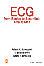 Ecg from basics to essentials step by step (january 11, 2016)_(1119066417)_(wiley blackwell)