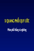 Xquang phổi quy ước