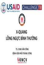 01. xquang ngực bình thường