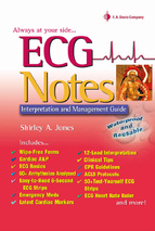 ECG notes   interpretation and management Guide