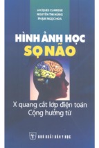 Hình ảnh học sọ não – x quang cắt lớp điện toán cộng hưởng từ