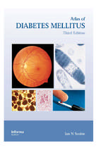 Atlas of diabetes mellitus, 3rd ed