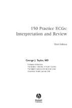 150.practice.ecgs.interpretation.and.review.3rd.ed