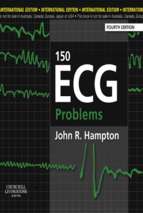 150ecgproblems,4thedition