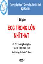 Bài giảng ecg lớn nhĩ thất