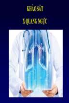 Bài giảng khảo sát x quang ngực