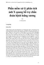 Phần mềm xử lý phân tích ảnh x quang hỗ trợ chẩn đoán bệnh loãng xương (1)