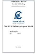 Phân tích kỹ thuật chụp x quang xóa nền