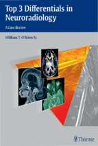 2015 top 3 differentials in neuroradiology