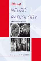 2012 atlas of neuroradiology_ 200 common cases   ammar haouimi_2