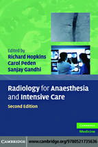 2010 radiology for anaesthesia and intensive care