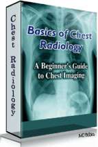 2012 basics of chest radiology   new edition   dr h. davies (contributing author)