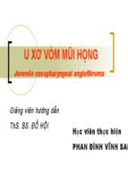 Bài thuyết trình u xơ vòm mũi họng